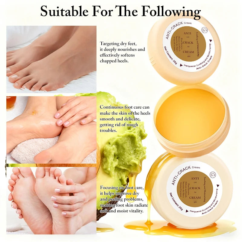 Crème Pieds Anti-Crevasses Hydratante - Traitement Talons Secs Fendillés Automne Hiver Élimine Peaux Mortes