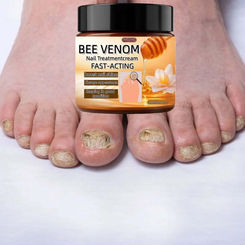 Crème Réparatrice pour Ongles - Soin Intensif Ongles Secs, Fragiles, Durcissement, Hydratation Rapide