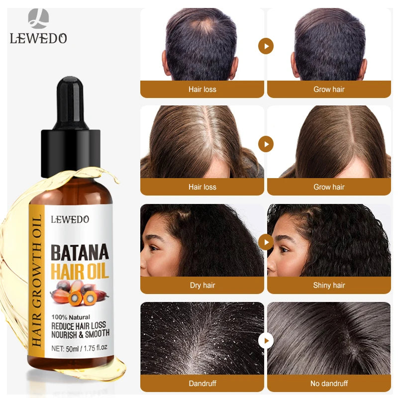 Huile Sérum Batana Croissance Cheveux Rapide - Huile Essentielle Anti-Chute Soin Beauté Réparation Naturelle Cheveux Abîmés