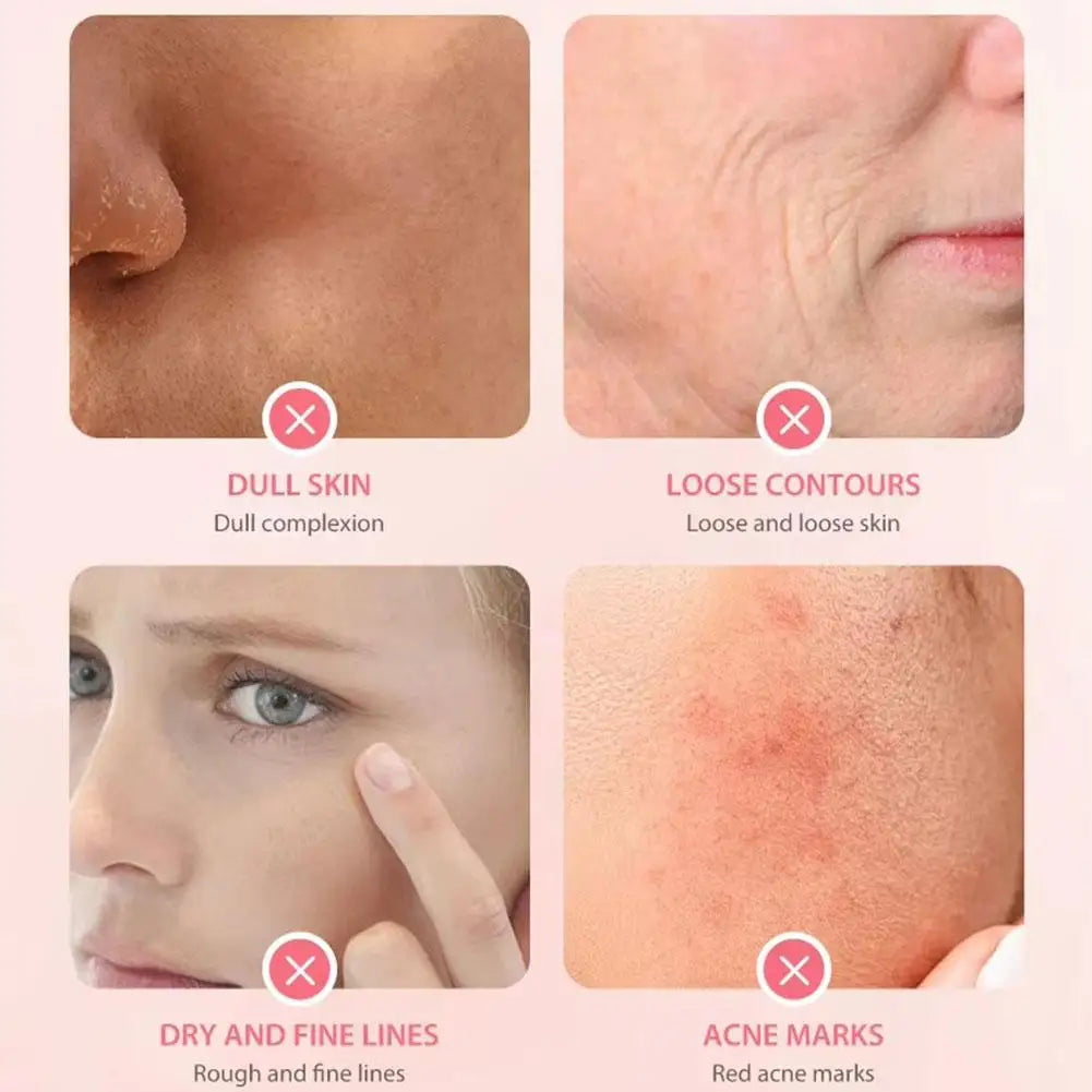 Crème Vichy Rose Platine 50ml - Hydratant Anti-Âge Réparation Rougeurs Sensibilité Peau Automne Hiver