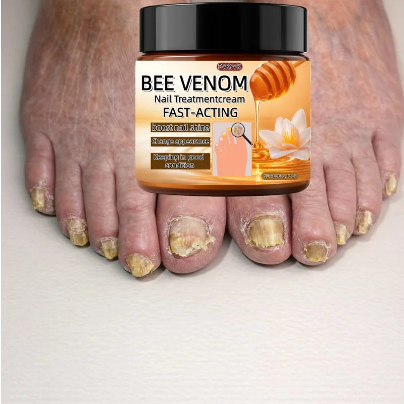 Crème Réparatrice pour Ongles - Soin Intensif Ongles Secs, Fragiles, Durcissement, Hydratation Rapide