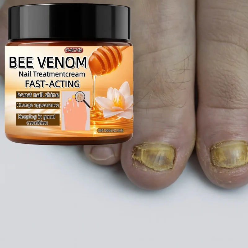 Crème Réparatrice pour Ongles - Soin Intensif Ongles Secs, Fragiles, Durcissement, Hydratation Rapide