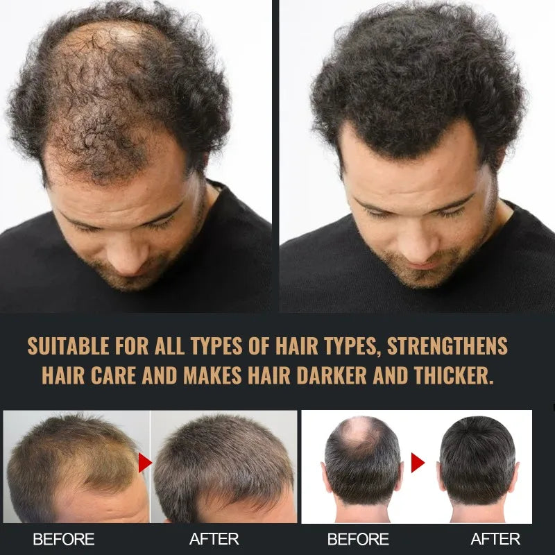 Shampooing Traitement Anti-Chute 100ml - Stimule Croissance Renforce Racines Réparation Cuir Chevelu Hydratant Épaississant