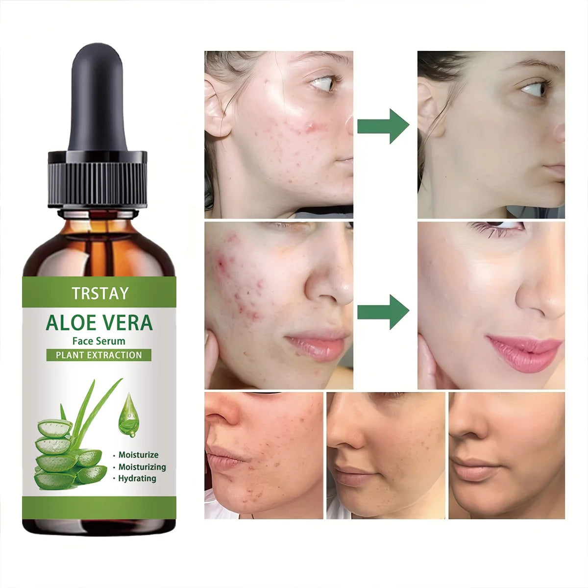 Sérum Visage Aloé Vera - Hydratation Intense Anti-Âge, Ingrédients Naturels, Huile Nourrissante Peau Tous Types