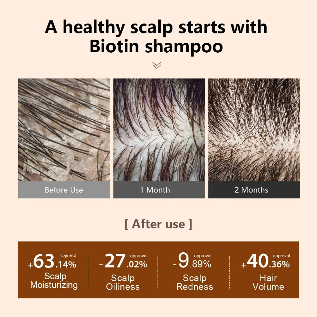 Shampooing et Après-Shampooing Biotine PURC - Soin Capillaire Homme Femme | Huile Croissance Cheveux